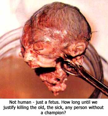 abortion 8 weeks. usually after 12 weeks,